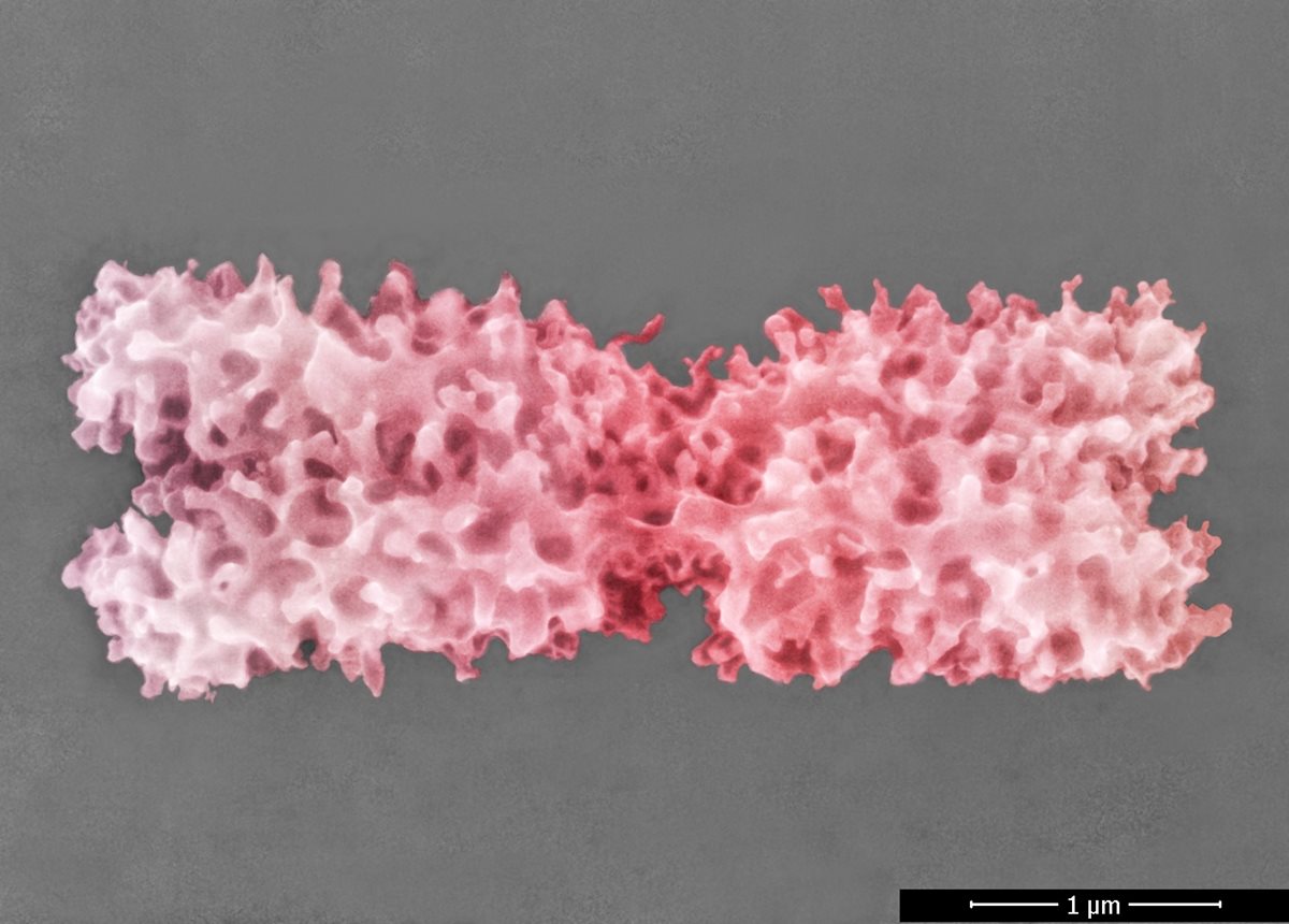Czechs first to image chromosome surface structure in natural state